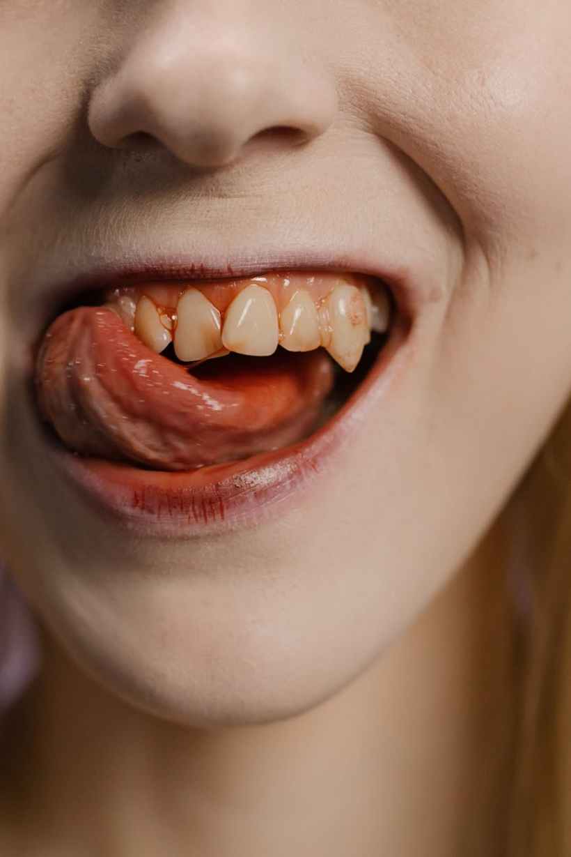 A close-up of a person's mouth.